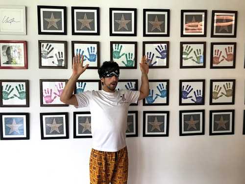 Jonny showing his hands